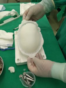 reconstrucao cranio6