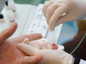 sifilis hiv e1784660627830