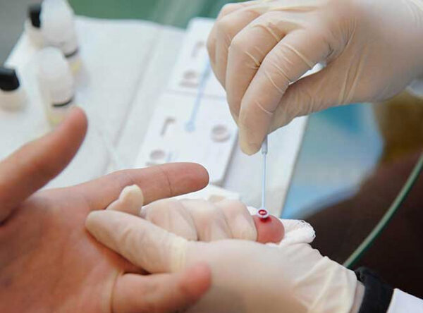Foz pode ampliar acesso a testes rápidos para ISTs sem necessidade de agendamento 1 sifilis hiv e1784660627830