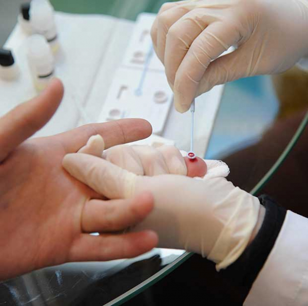 sifilis hiv