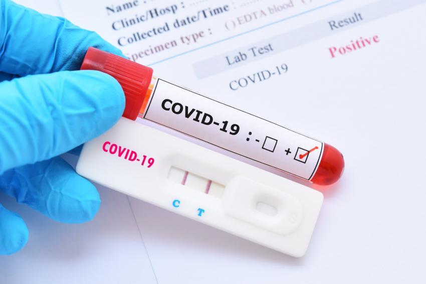 teste coovid