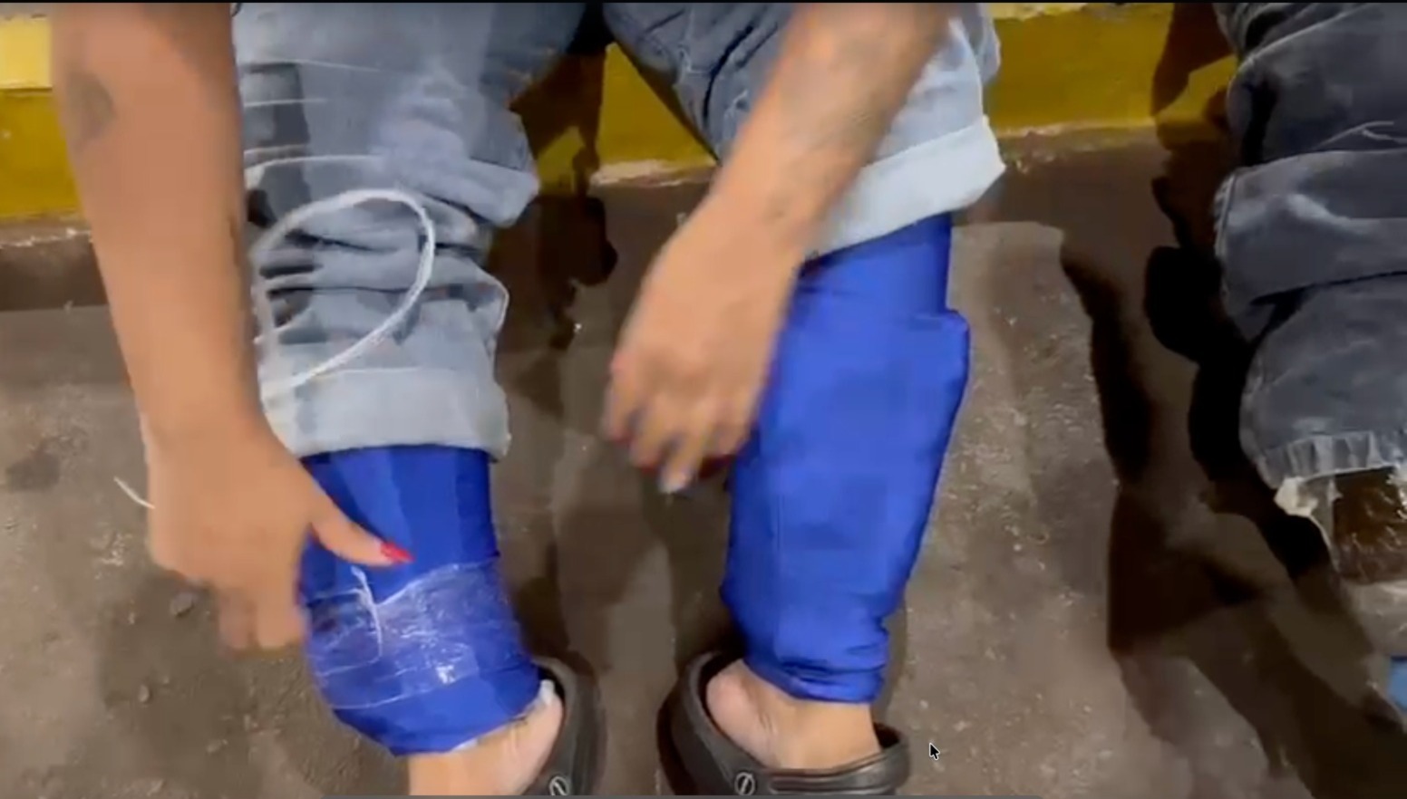 Duas mulheres são detidas na Ponte da Amizade com mais de 4,1 kg de haxixe amarrados às pernas. ASSISTA! 1 haxixe no corpo