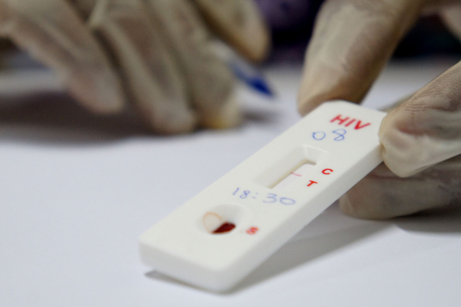 Justiça suspende exigência de teste de HIV em concurso público da Prefeitura de Foz do Iguaçu 1 16348642488 7b9f89d788 o